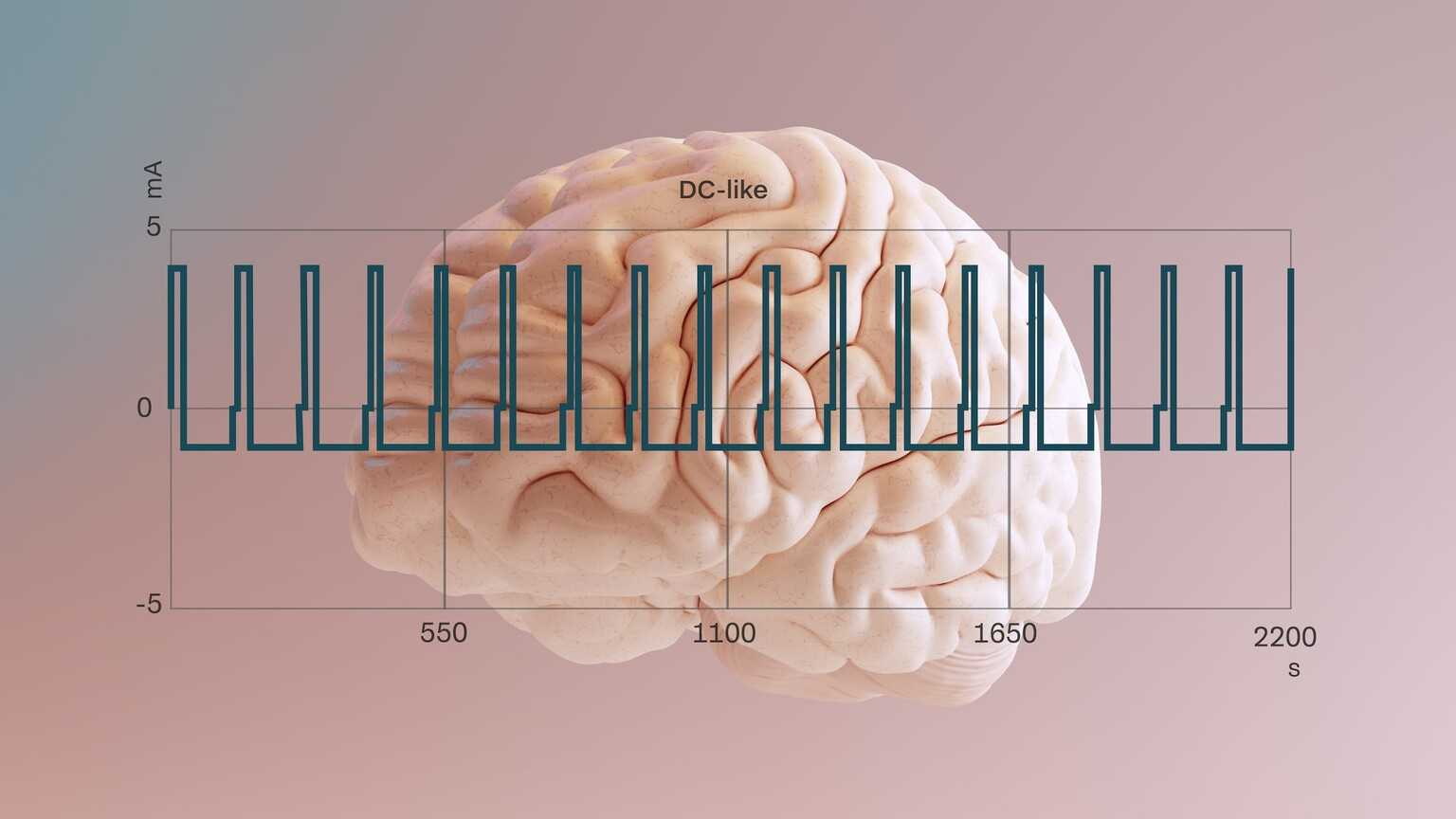 Gleichstrom-ähnliche Pulse für die Neuromodulation